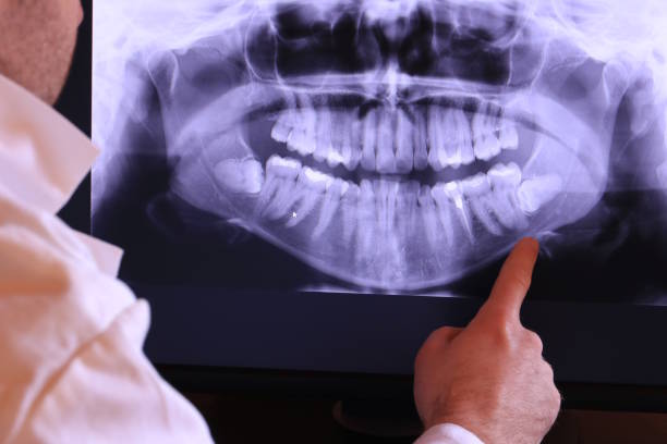 Best Emergency Dental Surgery in Melody Hill, IN